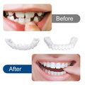 SnapOn Smile Dental Veneers - arabtijarah