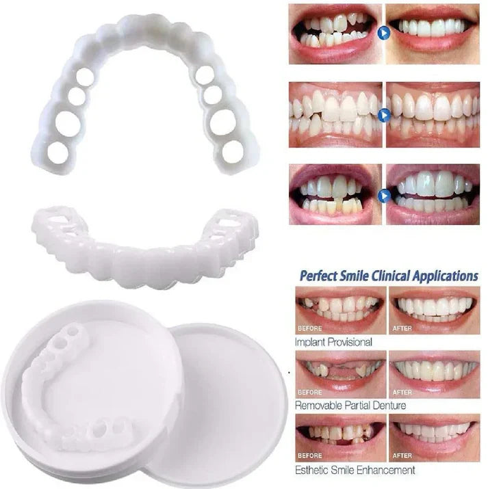 SnapOn Smile Dental Veneers - arabtijarah