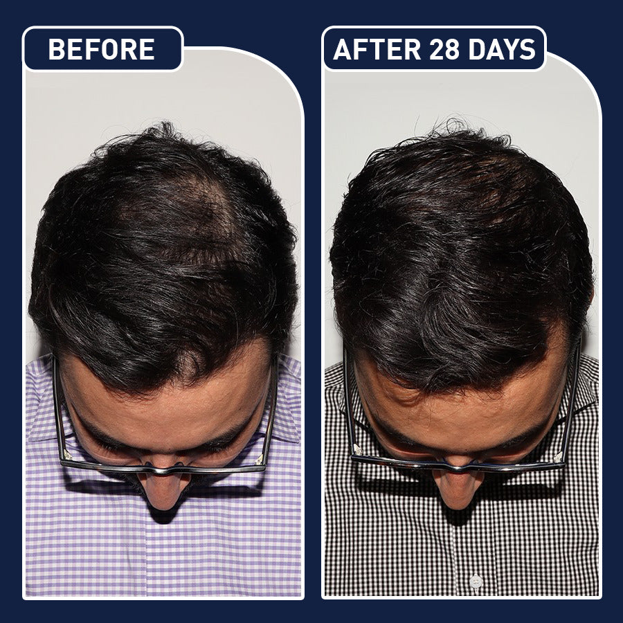 FEG Plus Hair Spray - arabtijarah